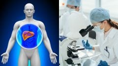 Stukovatením pečene trpí 40 % Slovákov: Nový výskum ukazuje, ako hesperetín odbúrava nebezpečný tuk