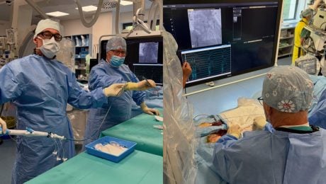 Tím Oddelenia arytmií a kardiostimulácie pod vedením primára MUDr. Petra Hliváka, PhD., MPH úspešne vykonal prvú implantáciu bezelektródového kardiostimulátora AveirTM.
