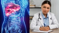 Hepatológ varuje, tiché ochorenie pečene má až 40 % Slovákov, väčšina o tom vôbec netuší. Apeluje na včasnú diagnostiku