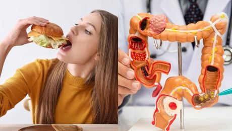 30 gramov obľúbenej potraviny zvyšuje šancu rakoviny o 9 %. Slováci ju majú na tanieri denne