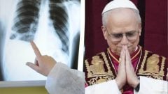 Rakovina, ktorú diagnostikovali aj pápežovi Levovi XIV., na Slovensku zabíja tisíce ľudí. Skrýva sa za banálne príznaky