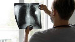 Smrtiaca baktéria po incidentu v Rusku straší verejnosť: Odborníci objasnili prvé príznaky a riziko prenosu do Európy